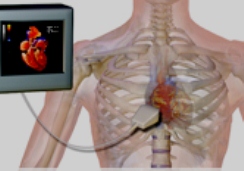 Эхокардиограмма зачастую совершенно лишнее исследование